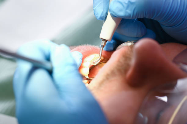 Best Broken or Cracked Tooth Emergency Dentist in Weed, CA