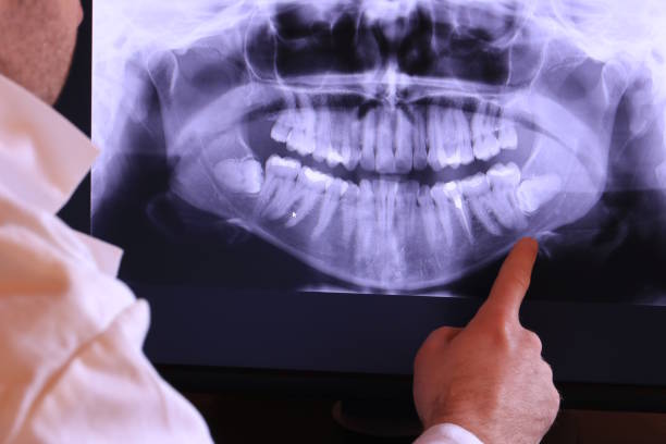 Best Emergency Dentist for Special Needs Patients in Weed, CA