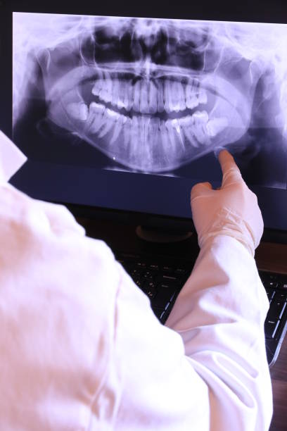 Best Emergency Root Canal Treatment in Weed, CA